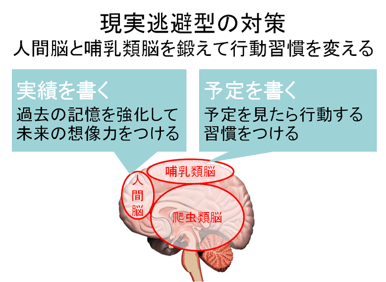 アルビス 先延ばし症候群その原因と対策